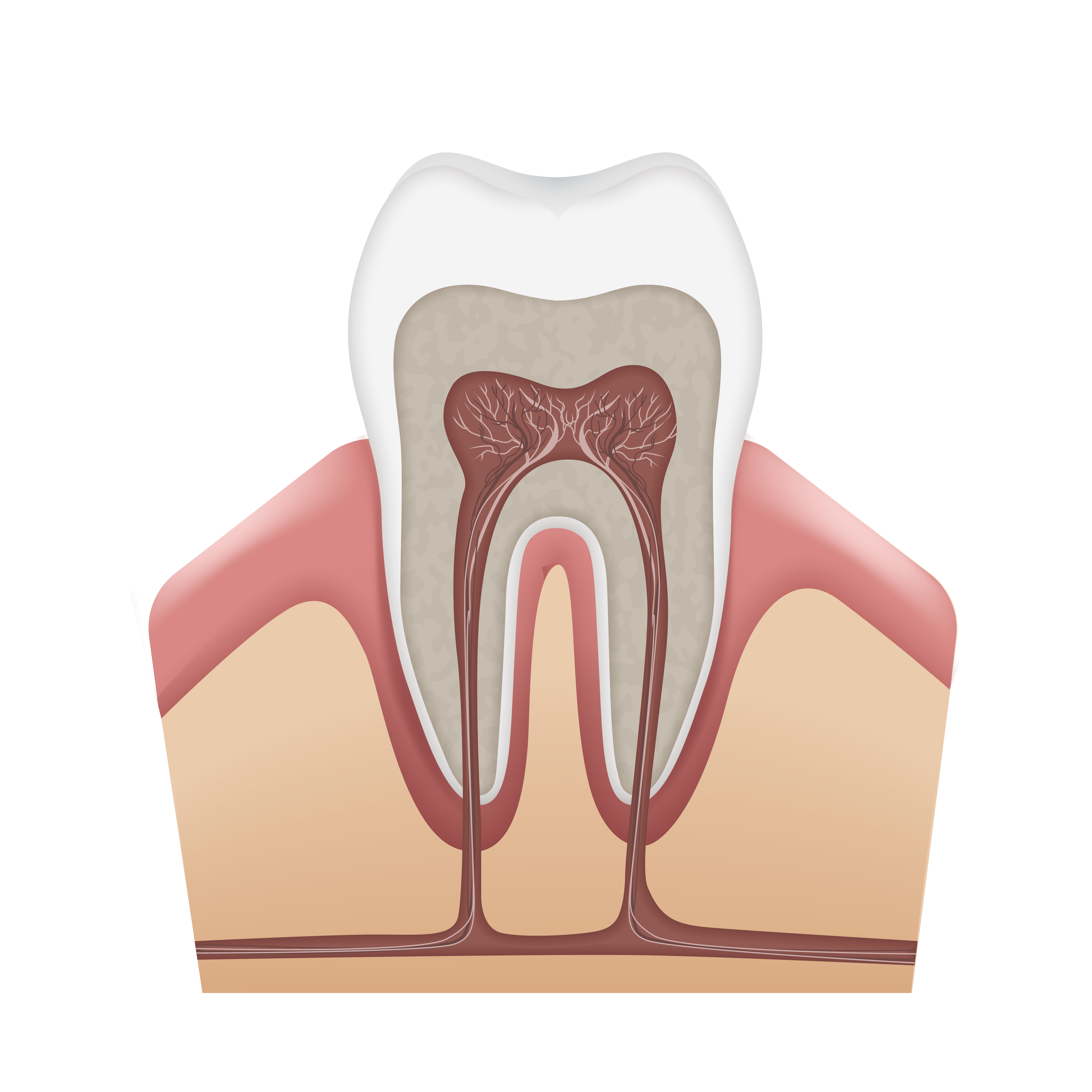 root canal treatment cost in chennai